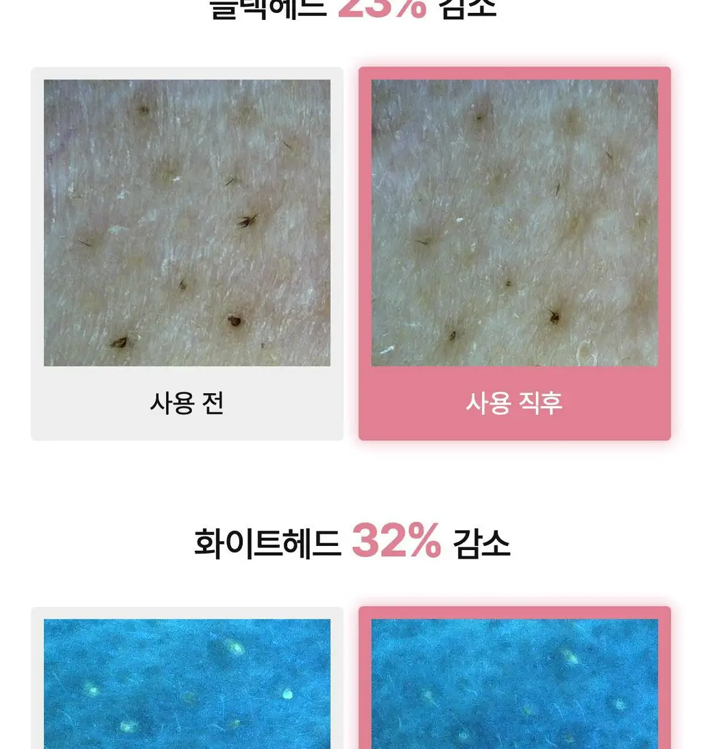 [탄탄모공/피지순삭] 바이오던스 콜라겐 클렌징 오일 200ml 단품/기획 상세페이지 16